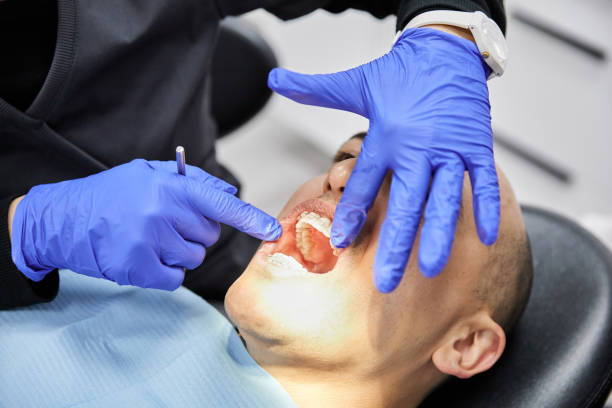 Best Emergency Root Canal Treatment in Manito, IL